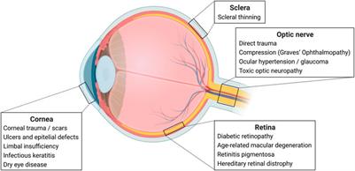 Insights and future directions for the application of perinatal derivatives in eye diseases: A critical review of preclinical and clinical studies